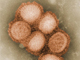 Imagem ao microscópio do vírus da gripe A/H1N1.(Foto : Goldsmith et Balish /AFP)