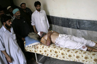A wounded Mohmand tribesman at a hospital in Peshawar(Photo: Reuters)