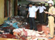 Victims at the site of a suicide bomb explosion in north-central Anuradhapura (Photo: Reuters)