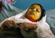 Shamsia, 17, victim of an acid attack by the Taliban(Credit: Reuters)