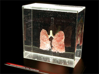 A pair of lungs(Photo: Organisers)