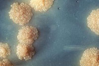 Cultura en laboratorio del Mycobacterium tuberculosis (bacilo de Koch).(© Wikipedia)