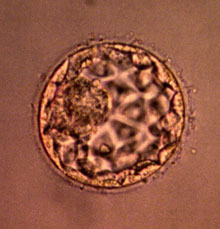 Embryon humain en éclosion, 5 jours après la micro-injection d'un spermatozoïde. 

		Photo : AFP