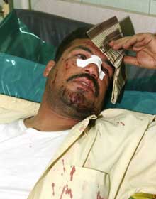 Cet homme a été blessé dans un double attentat à la voiture piégée, le 14 avril à Bagdad.(Photo: AFP)