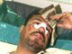 Blessé dans un attentat à Bagdad, le 14 avril 2005.(Photo: AFP)