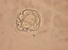 Embryon cloné. 

		(Photo: AFP)