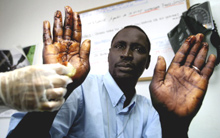 Un immigrant africain reçoit des soins après avoir tenté de franchir une barrière de barbelé. (photo : AFP)