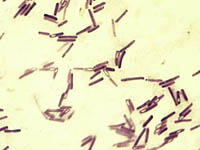 Les spores de Clostridium difficile le rendent particulièrement difficile à éliminer. 

		(Source : medecinepharmacie.univ-fcomte.fr)