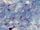 Représentation photographique du bacille tuberculeux rouge. 

		(Photo : AFP)