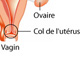 Représentation graphique du col de l'utérus. 

		(Photo : http://www.eccce-cervical-cancer.org)