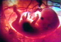 Seules 1% des cellules du liquide amniotique disposent des deux plus importantes propriétés des cellules souches de l'embryon, à savoir polyvalence et capacité au renouvellement. 

		(Photo: AFP)