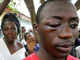 Un étudiant raconte comment il a été frappé par des militaires dans la banlieue de Conakry. 

		(Photo : AFP)