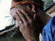 Cette pollution a provoqué la mort d'au moins 16 personnes et l'intoxication de milliers d'autres.&nbsp;Deux ans après l'incident, les symptômes n'ont toujours pas disparu, comme cette&nbsp;ivoirienne qui souffre de&nbsp;graves problèmes de peau.(Photo : AFP)