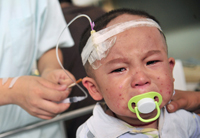 Cet enfant de deux ans souffre de calculs rénaux après avoir bu du lait contaminé.(Photo : Reuters)