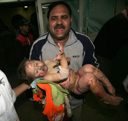 Un père emmène sa fille d'urgence à l'hôpital, à Gaza, le 4 janvier 2009. L'offensive israélienne a fait au moins 500 morts palestiniens en neuf jours dans la bande de Gaza.(Photo : AFP)