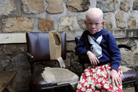 Enfant burundais de la Maison des Albinos à Ruyigi.(Photo : Stéphane Sakutin/AFP)