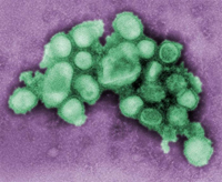 Vue sous microscope du virus de la grippe A&nbsp;H1N1.(Photo : AFP)