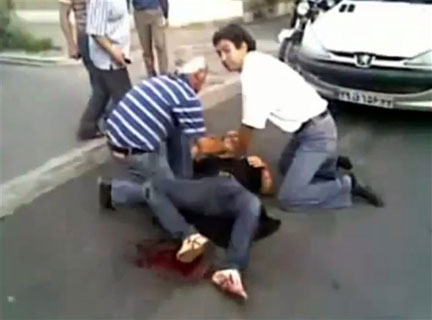 Image extraite d'une vidéo postée sur YouTube montrant un blessé après la manifestation du 20 juin à Téhéran.(Source: AFP / You Tube)