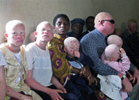 Des albinos attendent le verdict du procès des responsables de crimes rituels d'albinos, à Ruyigi le 24 juillet 2009.(Photo :  Esdras Ndikumana/AFP)
