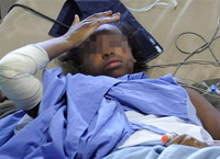 La jeune comorienne Bahia, 12 ans, seule rescapée du crash, à l'hôpital de Moroni, le 1er juillet 2009.(Photo : AFP)