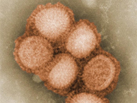 Wirus grypy A/H1N1 widziany pod mikroskopem.(Foto: Goldsmith et Balish /AFP)