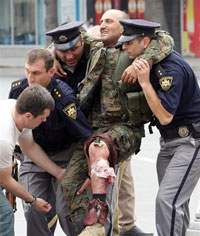 Грузинские полицейские эвакуируют раненого в ходе боев в Южной Осетии 8 августа 2008(Photo: AFP)