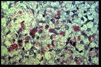 Микобактерии лепры под микроскопом
(Photo : Wikimedia)