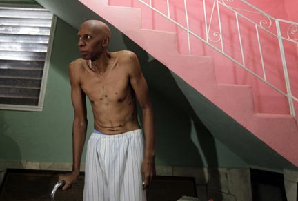 Кубинский диссидент Гильермо Фариньос на восьмой день сухой голодовки 5 марта 2010 г.
(Photo : REUTERS/Desmond Boylan)
