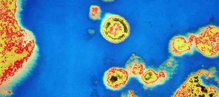 Hình chụp qua kính hiển vi siêu vi khuẩn VIH(Photo: AFP)