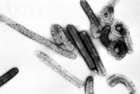 Le virus de Marburg fait partie de la famille des filoviridés, la même que le virus Ebola. Il infecte les cellules des parois des vaisseaux sanguins et des groupes de cellules immunitaires.(DR)