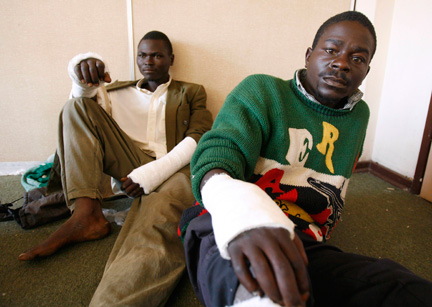 Des militants du MDC montrent leurs fractures après avoir été attaqués à Harare, le 3 mai 2008.(Photo : Reuters)