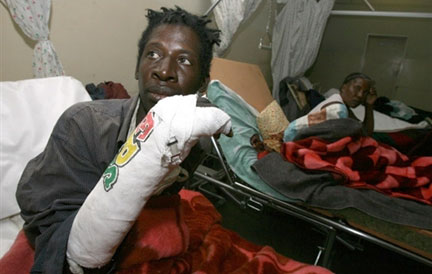 Un militant du MDC victime de violences lorsqu'il tentait de trouver refuge à l'ambassade d'Afrique du sud, le 7 juillet 2008.(Photo : AFP)