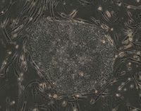 La cellule souche créée à partir de cellules de l'épiderme.(Photo : Reuters)
