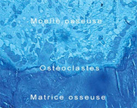 Les cellules à l'oeuvre dans la résorption de l'os ancien et la formation de la nouvelle matrice osseuse© Pierre Marie/ Cnrs
