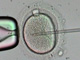 Parmi les techniques d'aide aux couples stériles pour réaliser leur désir d’enfant, ICSI (IntraCytoplasmic Sperm Injection) : la micro-injection d'un spermatozoïde dans un ovocyte.(Source : Cité des sciences et de l'industrie)