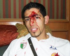 Le joueur algérien Rafik Halliche, le visage en sang, le 12 novembre 2009 au Caire.